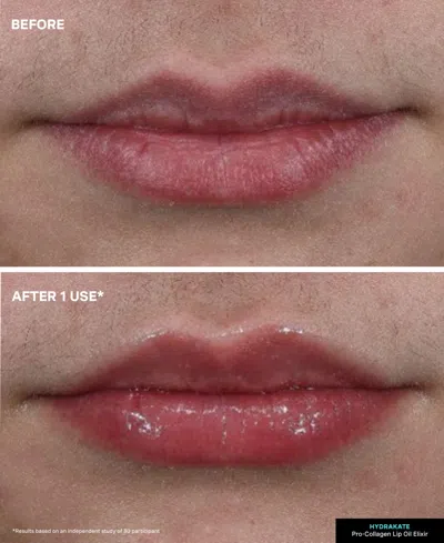 Kate Somerville Hydrakate Pro-collagen Lip Oil Elixir 7ml In Blue