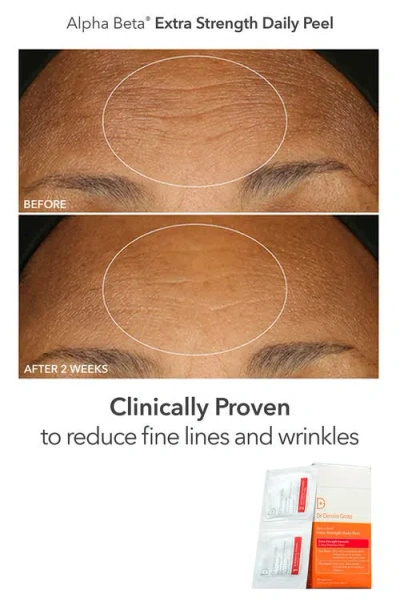 Dr Dennis Gross Skincare Alpha Beta Peel Vault Gift Set In Transparent