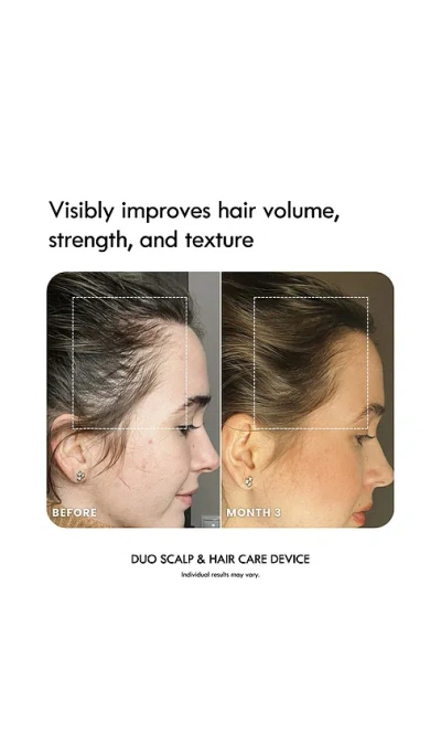 Laduora Duo 4-in-1 Pod Based Scalp & Hair Care Device In Blue