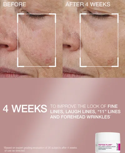 Strivectin 4-pc. Neck And Hydrating Face Cream With Serum Gift Set In Transparent