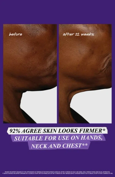 Kiehl's Since 1851 Micro-dose Anti-aging Retinol Serum With Ceramides And Peptide In Transparent