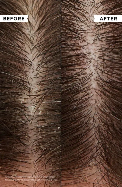 Philip Kingsley Flaky Itchy Scalp Hydrating Curl Anti-dandruff Shampoo 250ml In Multi