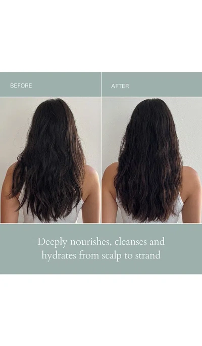 Rōz Hair Healthy Hair And Scalp Kit In Transparent