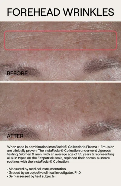 Dr. Diamond’s Metacine Travel Instafacial Plasma Bioactive Growth Factor Serum In Multi