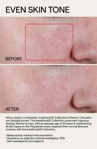 Dr. Diamond’s Metacine Travel Instafacial Plasma Bioactive Growth Factor Serum In Multi