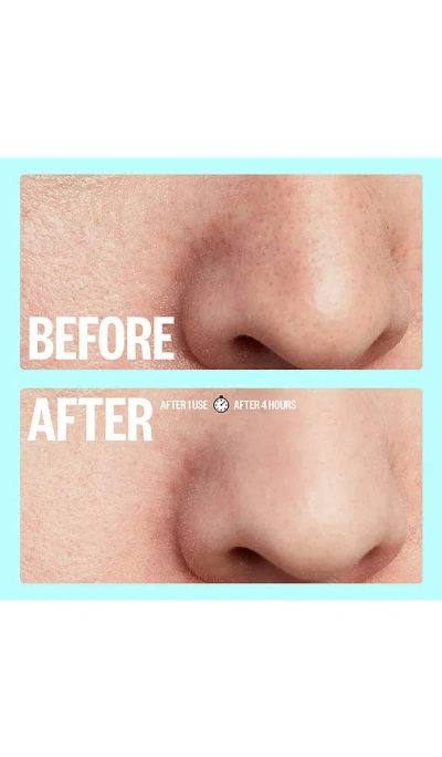 Peace Out Oil-absorbing Pore Treatment Strips In White