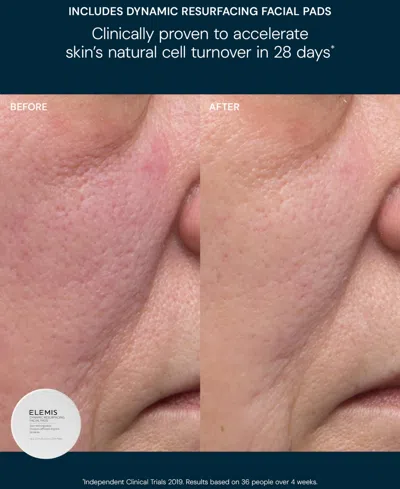 Elemis 2-pc. Glow Bright Resurfacing Set In Multi