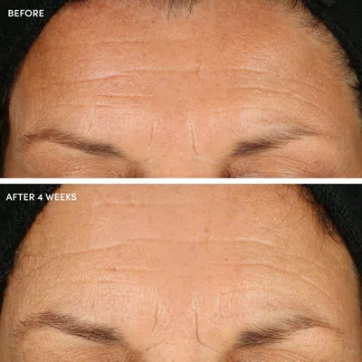 Naturopathica 10% Glycolic Acid + Aloe Vera Resurfacing Pads In Blue