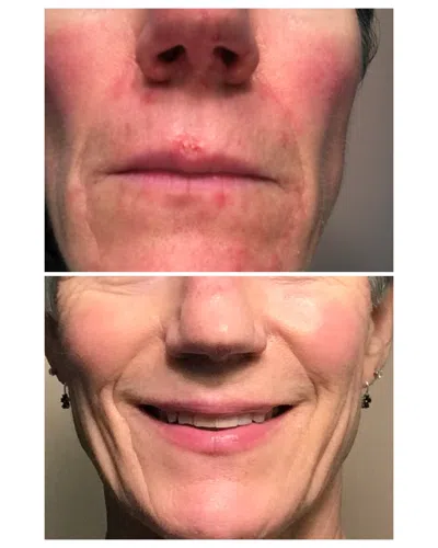 Naturopathica Holistic Health Carrot Seed Soothing Facial Oil