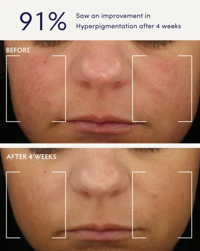 Naturopathica Holy Basil & Bakuchiol Ageless Night Oil In Multi