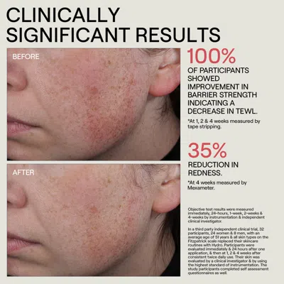 Dr. Diamond’s Metacine Hydr/o Bioactive Hydrolipid Barrier Moisturizer