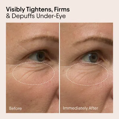 Alpyn Beauty Line-filling Eye Cream With Bakuchiol And Caffeine