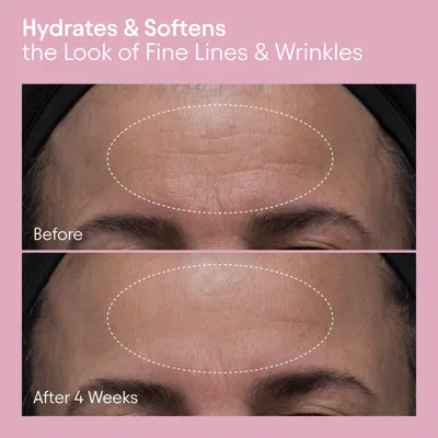 Alpyn Beauty Melt Moisturizer For Firming, Plumping And Brightening