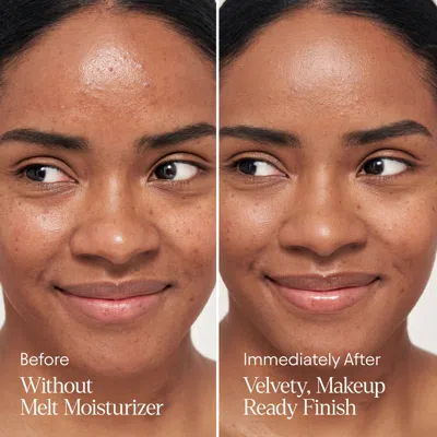 Alpyn Beauty Melt Moisturizer For Firming, Plumping And Brightening