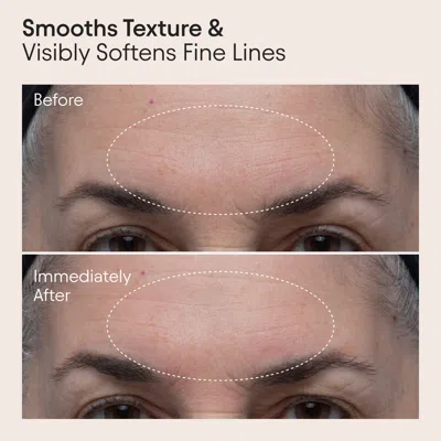 Alpyn Beauty Polishing Peel And Brightening Face Mask With 8 Acids And Huckleberry