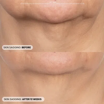 Dr. Whitney Bowe Beauty Procedure Enhancement Program In Transparent