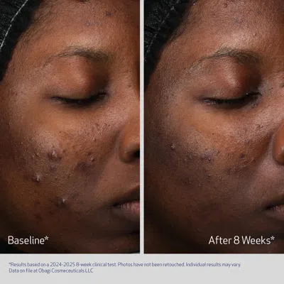 Obagi Retinol + Pha Refining Night Cream