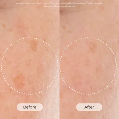 Dr. Whitney Bowe Beauty Skin Cycling Program In Multi