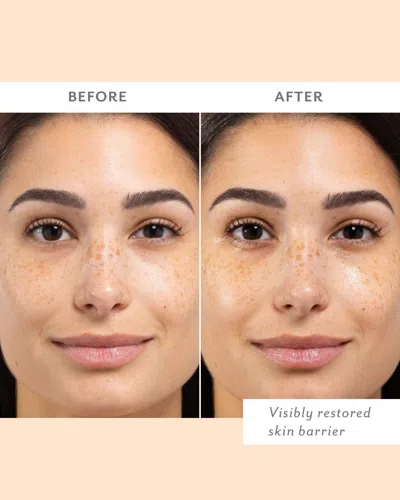 Patchology Skin Remedy Barrier-boosting Sheet Mask