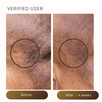 Plantkos Triple C Serum