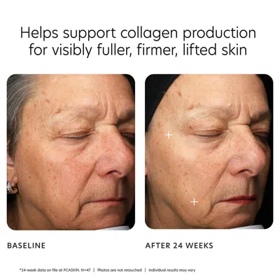 Pca Skin Mgf Age Renewal Cream In Transparent