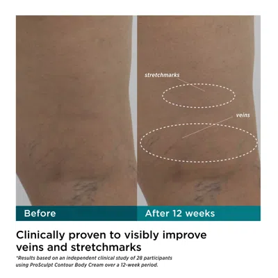 M-61 Prosculpt Contour Set With Tool In Transparent