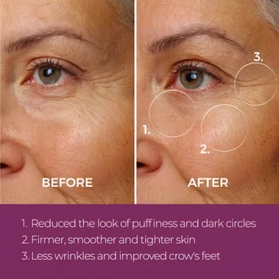 Blinc Eye Repair Peptide Complex In Multi