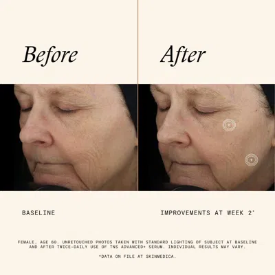 Skinmedica Tns Advanced+ Serum In White