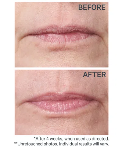Strivectin Double Fix For Lips Plumping & Vertical Line Treatment In White