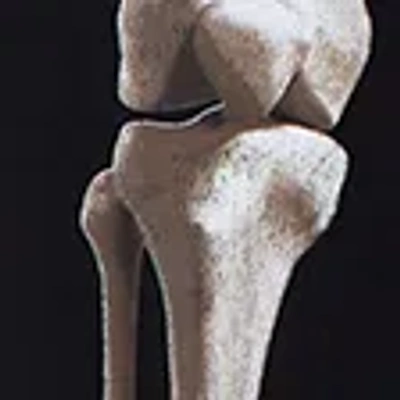 Abercrombie & Fitch Spooky Glow-in-the-dark Twofer Shorts In Black