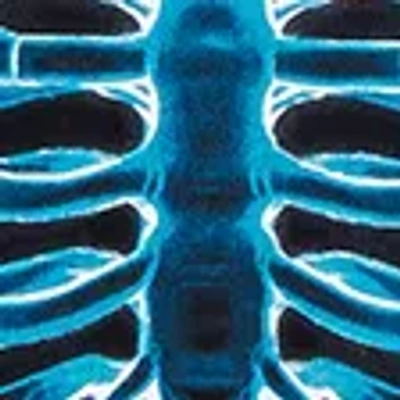 Abercrombie & Fitch Glow-in-the-dark Graphic Tee In Multi