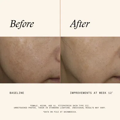 Skinmedica Even & Correct Advanced Brightening Treatment In White
