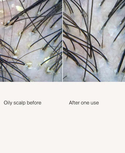 Living Proof Scalp Care Exfoliator Treatment In Blue