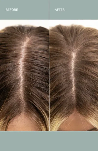 Roz Salt Scalp Scrub In Green