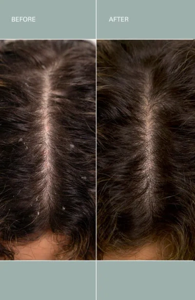 Roz Salt Scalp Scrub In Green