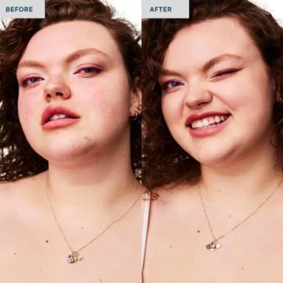 Spatch Invisble Spot Fix