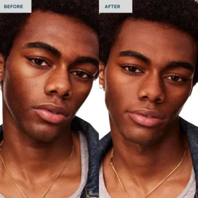 Spatch Invisble Spot Fix