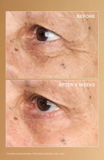Perricone Md Neuropeptide Brightening Under-eye Cream In Transparent
