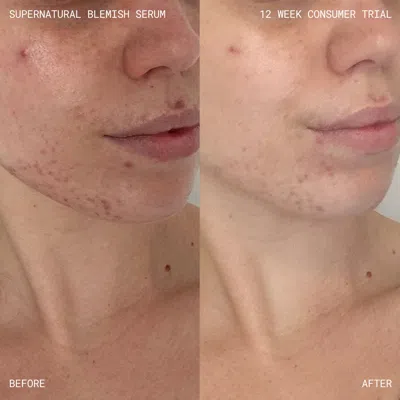 Emma Lewisham Supernatural Blemish Face Serum Refill In Blue
