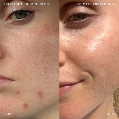 Emma Lewisham Supernatural Blemish Face Serum Refill In Blue