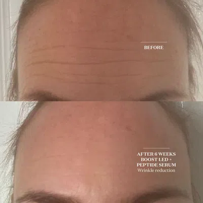 The Light Salon Boost Led Mask In White