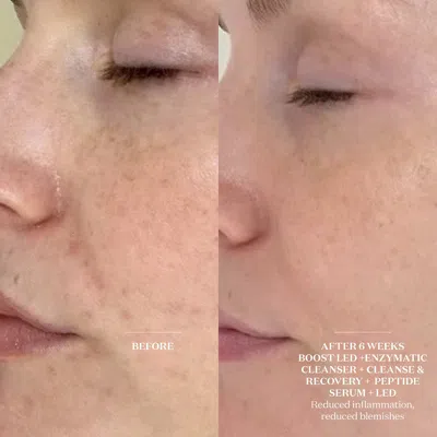 The Light Salon Boost Led Mask In White