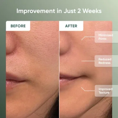 Nanoleaf Led Light Therapy Face Mask In Multi