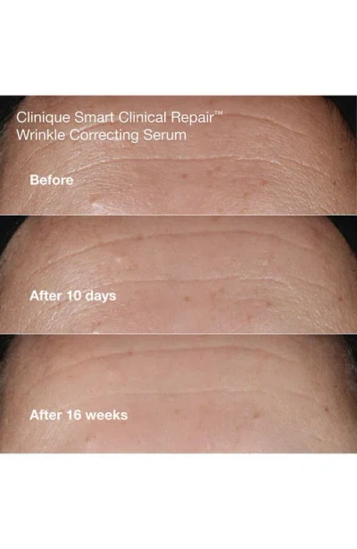 Clinique 3-pc. Anti-aging Routine Skincare Set In Transparent