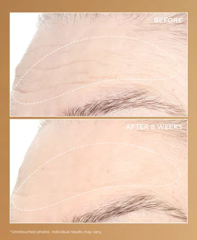Perricone Md Neuropeptide Pro-strength Firming Moisturizer In Brown