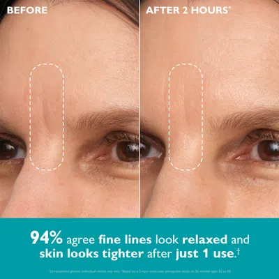 Peter Thomas Roth Peptide Skinjection™ Peptide-infused Face & Eye Tape In Transparent