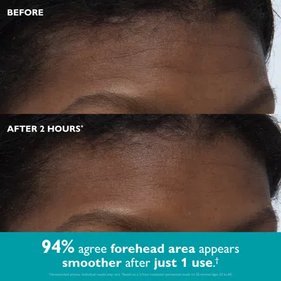 Peter Thomas Roth Peptide Skinjection™ Peptide-infused Face & Eye Tape In Transparent