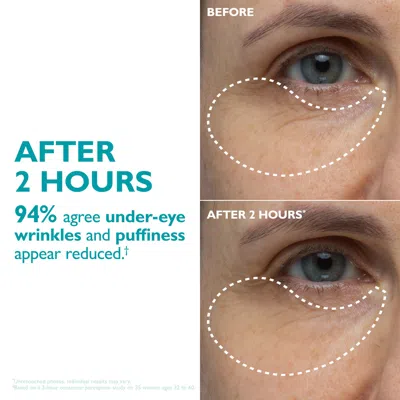 Peter Thomas Roth Peptide Skinjection™ Peptide-infused Face & Eye Tape In Transparent