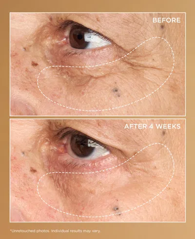 Perricone Md Neuropeptide Brightening Under-eye Cream In Transparent