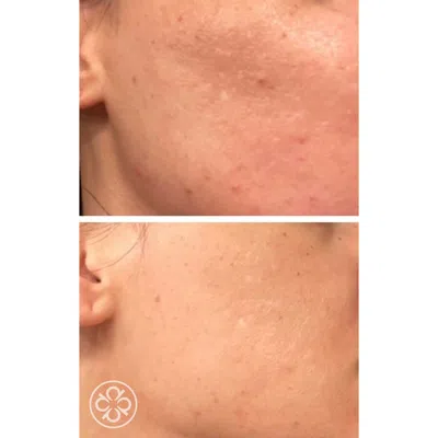 Pevonia Procorrective Clear-control Mask In White